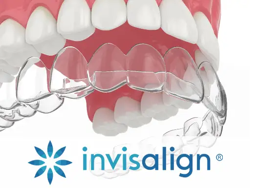 CLEAR SMILE ALIGNERS